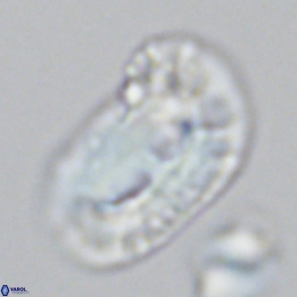 Helicosphaera carteri epimikeisporous VR 09814