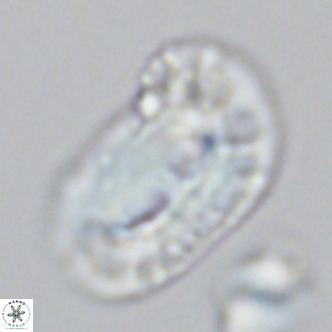 Helicosphaera carteri epimikeisporous VR 09814