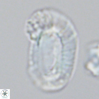 Helicosphaera carteri epimikeisporous VR 09815