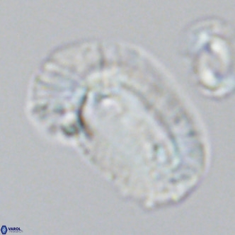 Helicosphaera carteri epimikeisporous VR 09816