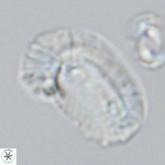 Helicosphaera carteri epimikeisporous VR 09816