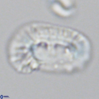 Helicosphaera carteri epimikeisporous VR 09817