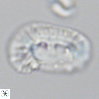 Helicosphaera carteri epimikeisporous VR 09817