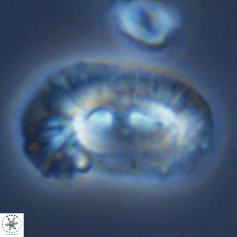 Helicosphaera carteri epimikeisporous VR 09818