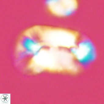 Helicosphaera carteri epimikeisporous VR 09810