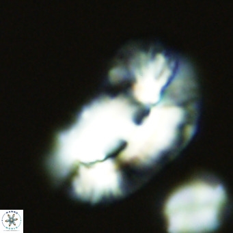 Helicosphaera carteri epimikeisporous VR 09811