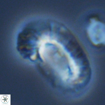 Helicosphaera carteri epimikeisporous VR 09820