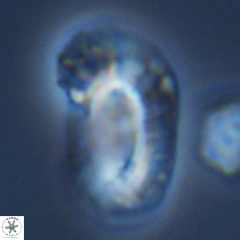 Helicosphaera carteri epimikeisporous VR 09821