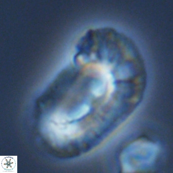 Helicosphaera carteri epimikeisporous VR 09822