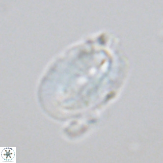 Helicosphaera carteri kamptneri VR 05345