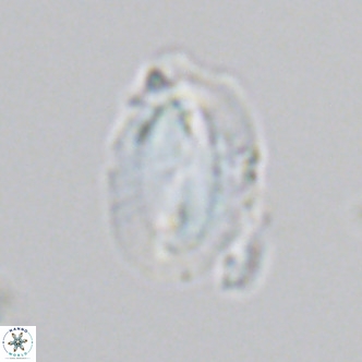 Helicosphaera carteri kamptneri VR 05346