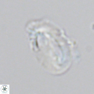Helicosphaera carteri kamptneri VR 05347