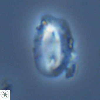Helicosphaera carteri kamptneri VR 05349