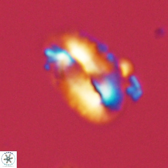Helicosphaera carteri kamptneri VR 05341