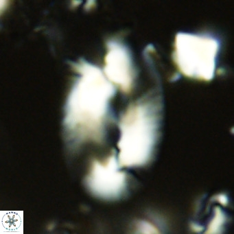 Helicosphaera carteri rotundus VR 05648