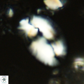 Helicosphaera carteri rotundus VR 05649