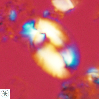 Helicosphaera carteri rotundus VR 05650