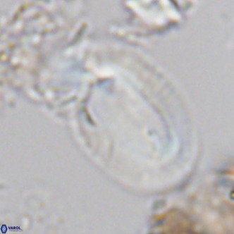 Helicosphaera carteri rotundus VR 05651