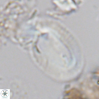 Helicosphaera carteri rotundus VR 05651