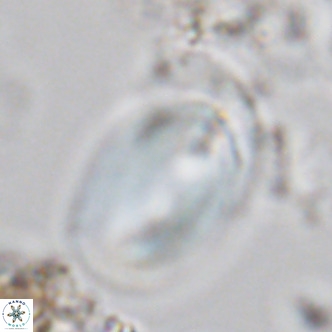 Helicosphaera carteri rotundus VR 05654