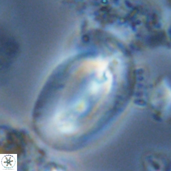 Helicosphaera carteri rotundus VR 05657