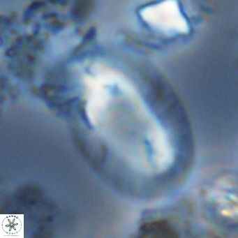 Helicosphaera carteri rotundus VR 05659