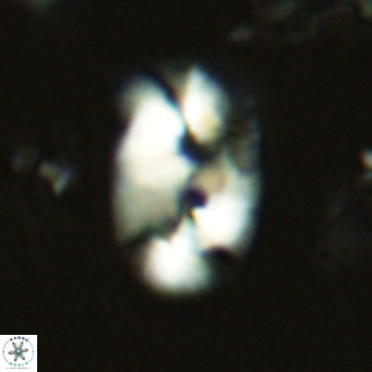 Helicosphaera carteri rotundus VR 05735