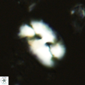 Helicosphaera carteri rotundus VR 05739