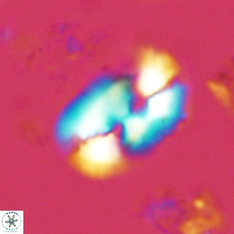 Helicosphaera carteri rotundus VR 05741