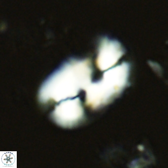 Helicosphaera carteri rotundus VR 05742