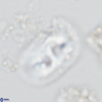 Helicosphaera carteri rotundus VR 05743