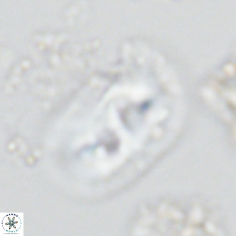Helicosphaera carteri rotundus VR 05743