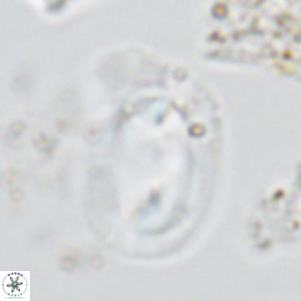 Helicosphaera carteri rotundus VR 05744