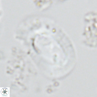Helicosphaera carteri rotundus VR 05745