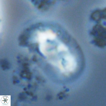 Helicosphaera carteri rotundus VR 05746