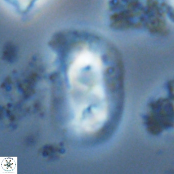 Helicosphaera carteri rotundus VR 05747