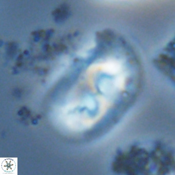 Helicosphaera carteri rotundus VR 05748