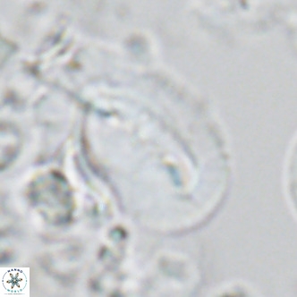 Helicosphaera carteri treisporoi VR 05502