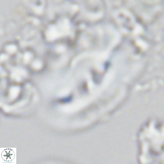 Helicosphaera carteri treisporoi VR 05505