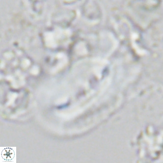 Helicosphaera carteri treisporoi VR 05506