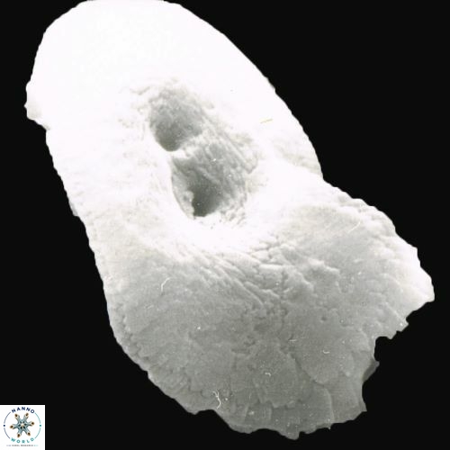 Helicosphaera carteri 1071 7