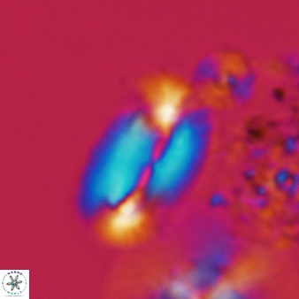Helicosphaera carteri 370