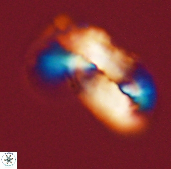 Helicosphaera carteri 47206