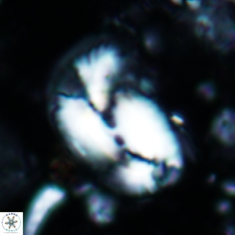 Helicosphaera carteri 660