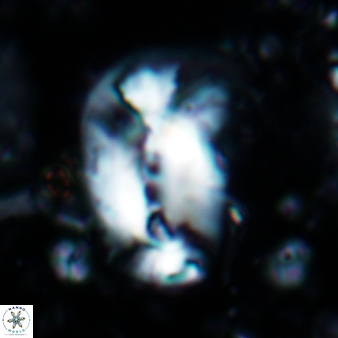 Helicosphaera carteri 663