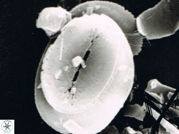 Helicosphaera carteri S20