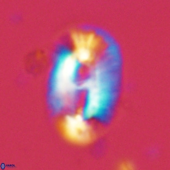 Helicosphaera cf carteri VR 03415