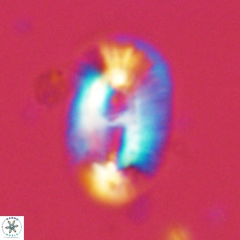 Helicosphaera cf carteri VR 03415