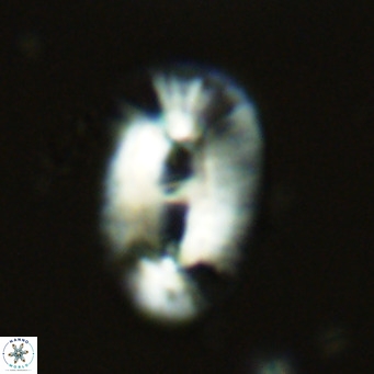 Helicosphaera cf carteri VR 03416