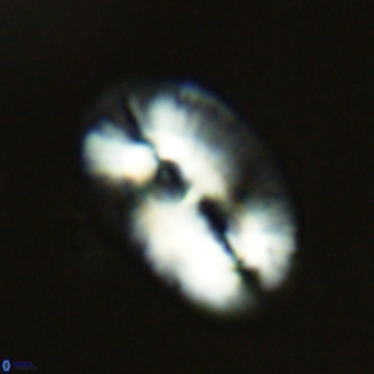 Helicosphaera carteri VR 03417
